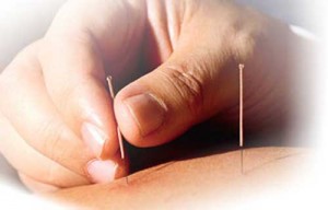 L'ACUPUNCTURE AU XXIème SIECLE